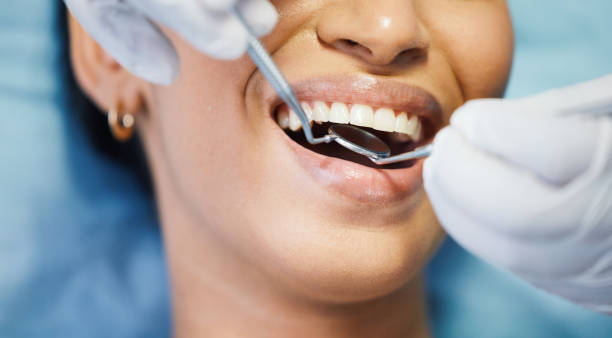 Best Urgent Tooth Repair  in Barnesville, MN