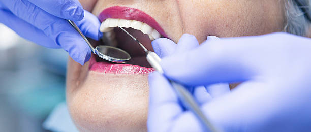 Best Dentist for Tooth Abscess  in Barnesville, MN