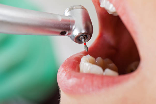 Urgent Tooth Repair in MN